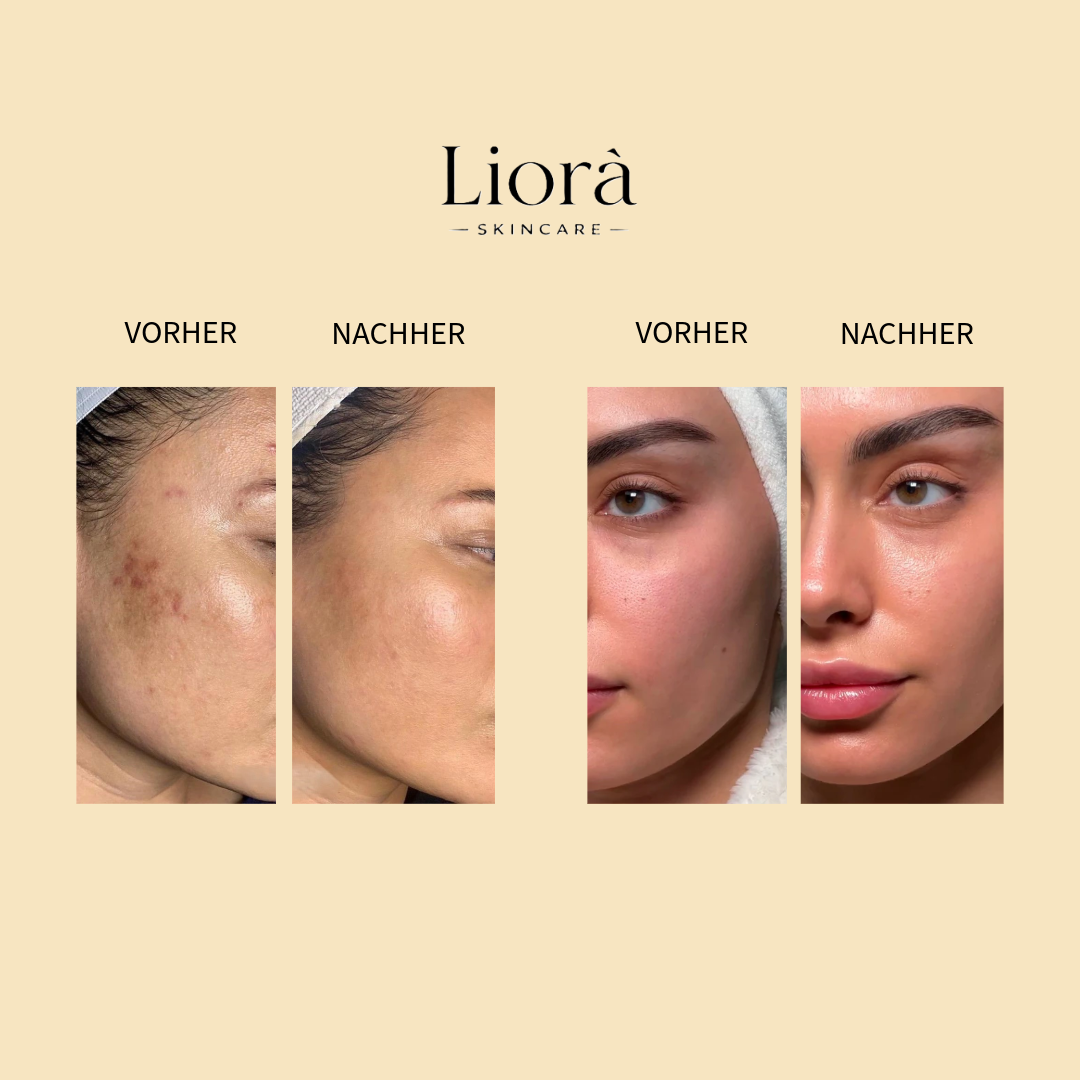 Liorà™ Vitamin C Serum
