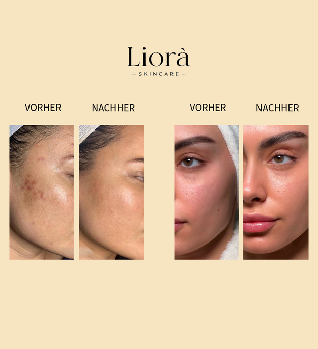 Liorà™ Vitamin C Serum