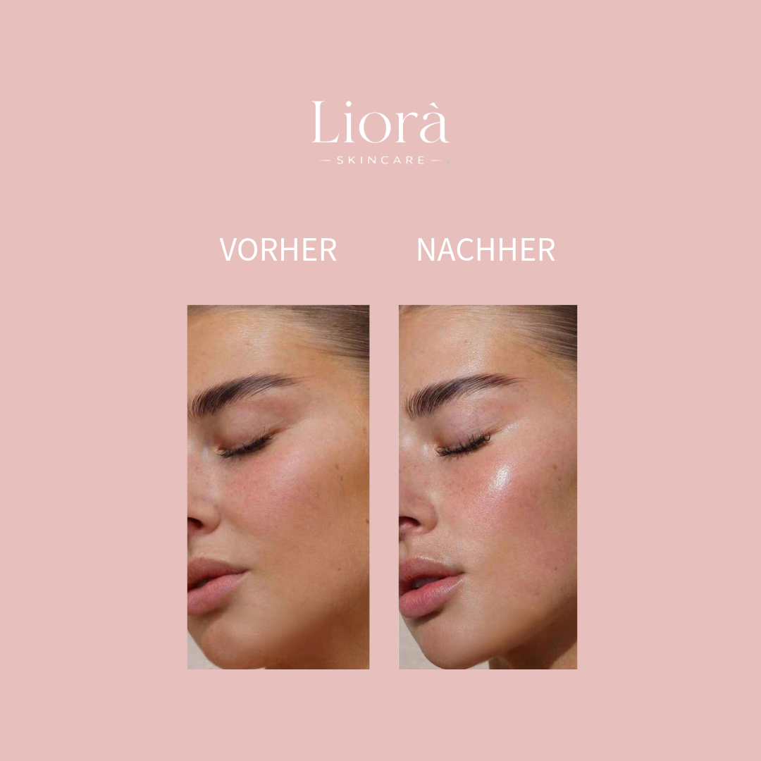 Liorà™ Collagen Hydrogel Maske