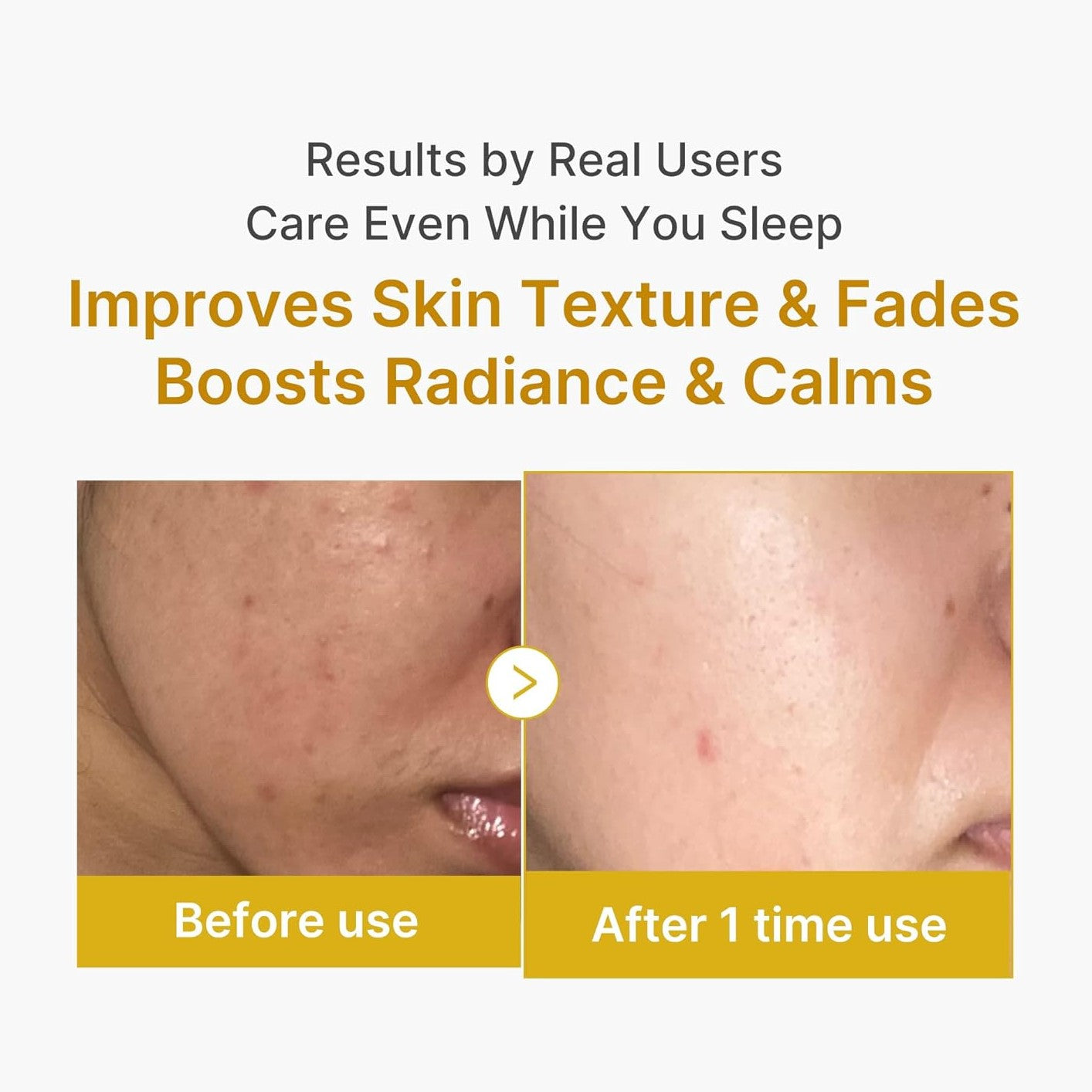 Liorà™ Overnight Peel-Off Maske