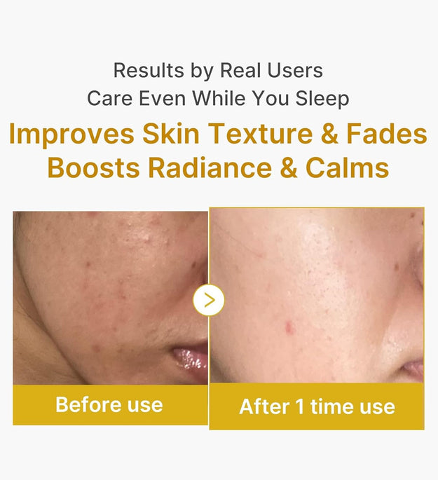 Liorà™ Overnight Peel-Off Maske
